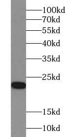 Western Blot: ACOT6 Antibody - BSA Free [NBP3-48234] - Mouse liver tissue were subjected to SDS PAGE followed by western blot with (ACOT6 antibody) at dilution of 1:1000