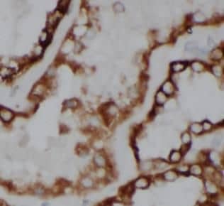 Immunohistochemistry: ACOT6 Antibody - BSA Free [NBP3-48234] - Immunohistochemistry of paraffin-embedded human kidney slide using (ACOT6 Antibody) at dilution of 1:50