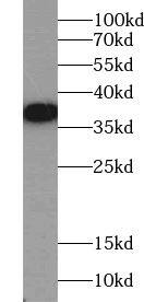 Western Blot: ACBD4 Antibody - BSA Free [NBP3-48237] - Human kidney tissue were subjected to SDS PAGE followed by western blot with (ACBD4 Antibody) at dilution of 1:1000