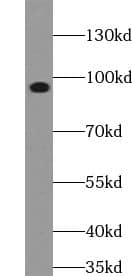 Western Blot ACAP3 Antibody - BSA Free