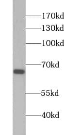 Western Blot ABLIM2 Antibody - BSA Free