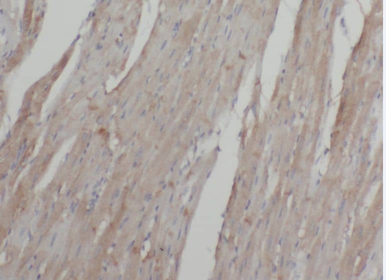 Immunohistochemistry ABLIM2 Antibody - BSA Free