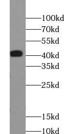 Western Blot ABHD12B Antibody - BSA Free
