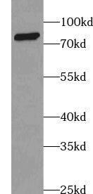 Western Blot ABCD2 Antibody - BSA Free