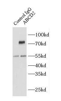 Immunoprecipitation: ABCD2 Antibody - BSA Free [NBP3-48249] - IP Result of anti-ABCD2 (IP:, 4ug; Detection: 1:300) with A431 cells lysate 1200ug.