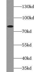 Western Blot: ABCB7 Antibody - BSA Free [NBP3-48250] - Mouse liver tissue were subjected to SDS PAGE followed by western blot with (ABCB7 antibody) at dilution of 1:1000