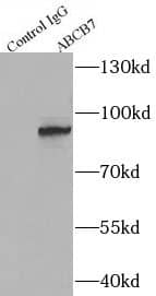 Immunoprecipitation: ABCB7 Antibody - BSA Free [NBP3-48250] - IP Result of anti-ABCB7 (IP: , 4ug; Detection:  1:500) with mouse liver tissue lysate 4000ug.