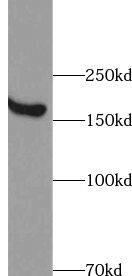 Western Blot: ABCA8 Antibody - BSA Free [NBP3-48253] - Mouse brain tissue were subjected to SDS PAGE followed by western blot with (ABCA8 Antibody) at dilution of 1:300