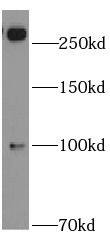 Western Blot ABCA2 Antibody - BSA Free