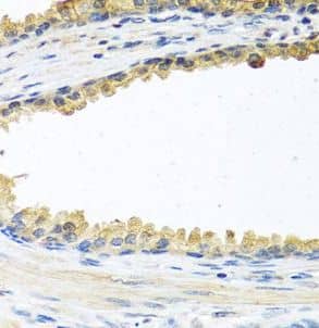 Immunohistochemistry: Cochlin Antibody - BSA Free [NBP3-48259] - Immunohistochemistry of paraffin-embedded human prostate using (Cochlin antibody) at dilution of 1:100