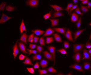 Immunocytochemistry/ Immunofluorescence Cochlin Antibody - BSA Free