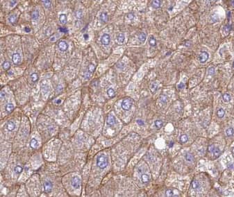 Immunohistochemistry GAGE8 Antibody - BSA Free