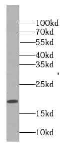 Western Blot GAGE8 Antibody - BSA Free