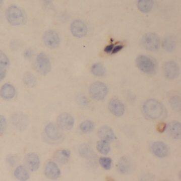 Immunohistochemistry: Neuropeptide B Antibody - BSA Free [NBP3-48266] - Immunohistochemistry of paraffin-embedded human brain using (Neuropeptide B antibody) at dilution of 1:50