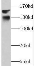 Western Blot: PHKA1 Antibody - BSA Free [NBP3-48267] - Mouse skeletal muscle tissue were subjected to SDS PAGE followed by western blot with ( PHKA1 Antibody) at dilution of 1:600