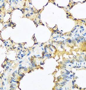 Immunohistochemistry: TSH beta Antibody - BSA Free [NBP3-48268] - Immunohistochemistry of paraffin-embedded mouse lung tissue slide using ( TSH beta antibody) at dilution of 1:100