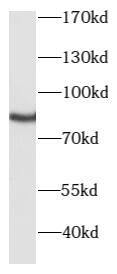 Western Blot: PKC gamma Antibody - BSA Free [NBP3-48269] - Mouse brain tissue were subjected to SDS PAGE followed by western blot with (PKC gamma antibody) at dilution of 1:1000