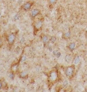 Immunohistochemistry: PKC gamma Antibody - BSA Free [NBP3-48269] - Immunohistochemistry of paraffin-embedded rat brain tissue slide using (PKC gamma Antibody) at dilution of 1:200