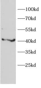 Western Blot: alpha 1B-Glycoprotein Antibody - BSA Free [NBP3-48270] - Mouse kidney tissue were subjected to SDS PAGE followed by western blot with (alpha 1B-Glycoprotein Antibody) at dilution of 1:1000