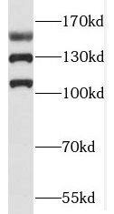 Western Blot: RAB3GAP2 Antibody - BSA Free [NBP3-48271] - Mouse brain tissue were subjected to SDS PAGE followed by western blot with (RAB3GAP2 Antibody) at dilution of 1:600