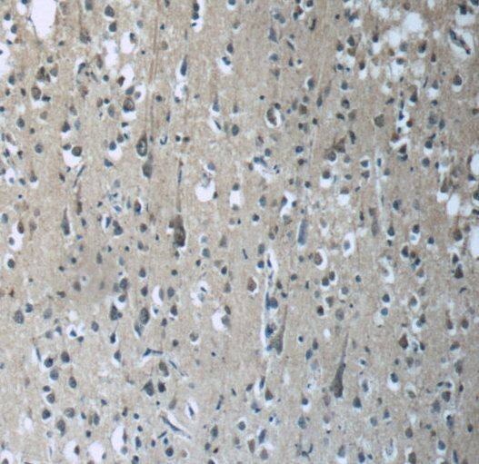 Immunohistochemistry: RAB3GAP2 Antibody - BSA Free [NBP3-48271] - Immunohistochemistry of paraffin-embedded human brain tissue slide using (RAB3GAP2 Antibody) at dilution of 1:50