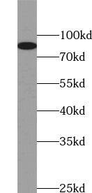Western Blot: HCN3 Antibody - BSA Free [NBP3-48278] - Human kidney tissue were subjected to SDS PAGE followed by western blot with (HCN3 antibody) at dilution of 1:800