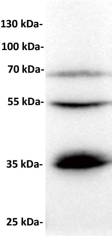 Anti-BTN3A1 antibody at 1/1000 dilutionLane : RPMI8226, whole cell lysateSecondary : Goat Anti-Rabbit IgG H&L (HRP) at 1/5000 dilutionPredicted band size: 33 kDa Observed band size: 35，54，68 kDa