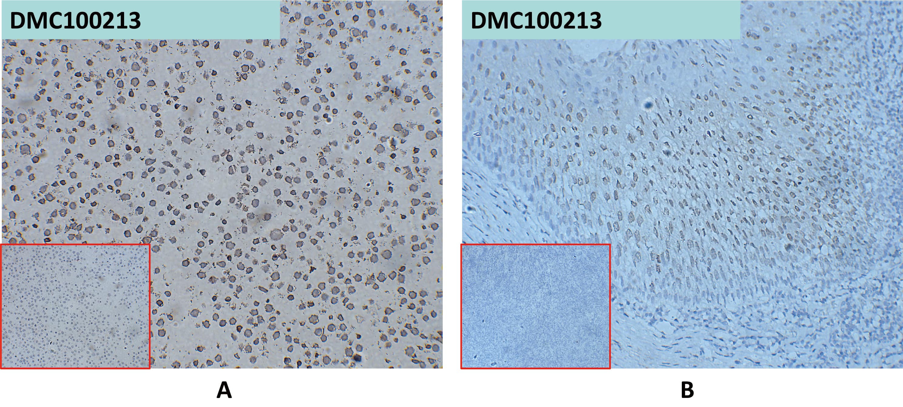 A. NBP3-48290 at 10ug/ml staining CD24 in K562-CD24 cells by IHC (Catalog Number# NBP3-48290);B. NBP3-48290 at 10ug/ml staining CD24 in human tonsil tissue by IHC (Catalog Number# NBP3-48290)