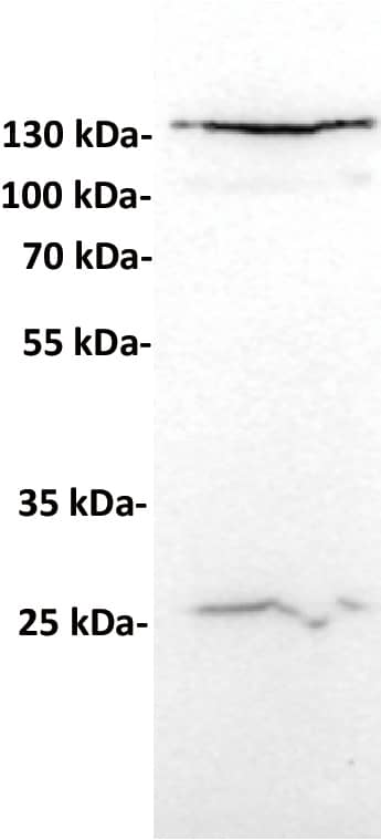 Anti-CD24 antibody (Catalog Number# NBP3-48290) at 1/1000 dilutionLane : Huh7, whole cell lysateSecondary : Goat Anti-Rabbit IgG H&L (HRP) at 1/5000 dilutionPredicted band size: 61 kDaObserved band size: 25, 135 kDa