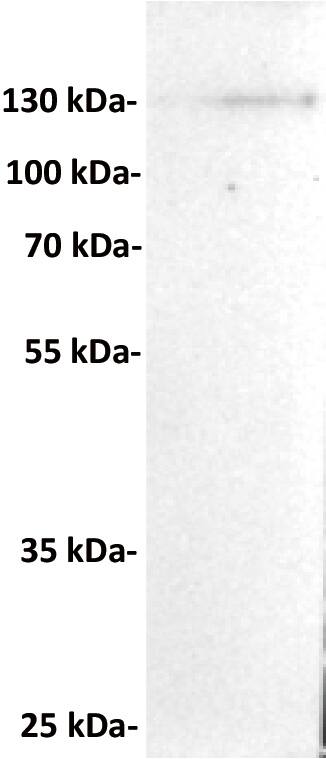 Anti-CD21 antibody (Catalog Number# NBP3-48307) at 1/1000 dilutionLane : RAJI, whole cell lysateSecondary : Goat Anti-Rabbit IgG H&L (HRP) at 1/5000 dilutionPredicted band size: 113 kDaObserved band size: 150 kDa