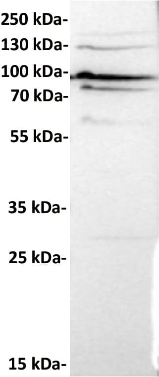 Anti-CDH6 antibody (Catalog Number# NBP3-48378) at 1/1000 dilutionLane : Huh7, whole cell lysateSecondary : Goat Anti-Rabbit IgG H&L (HRP) at 1/5000 dilutionPredicted band size: 88 kDaObserved band size: 95 kDa