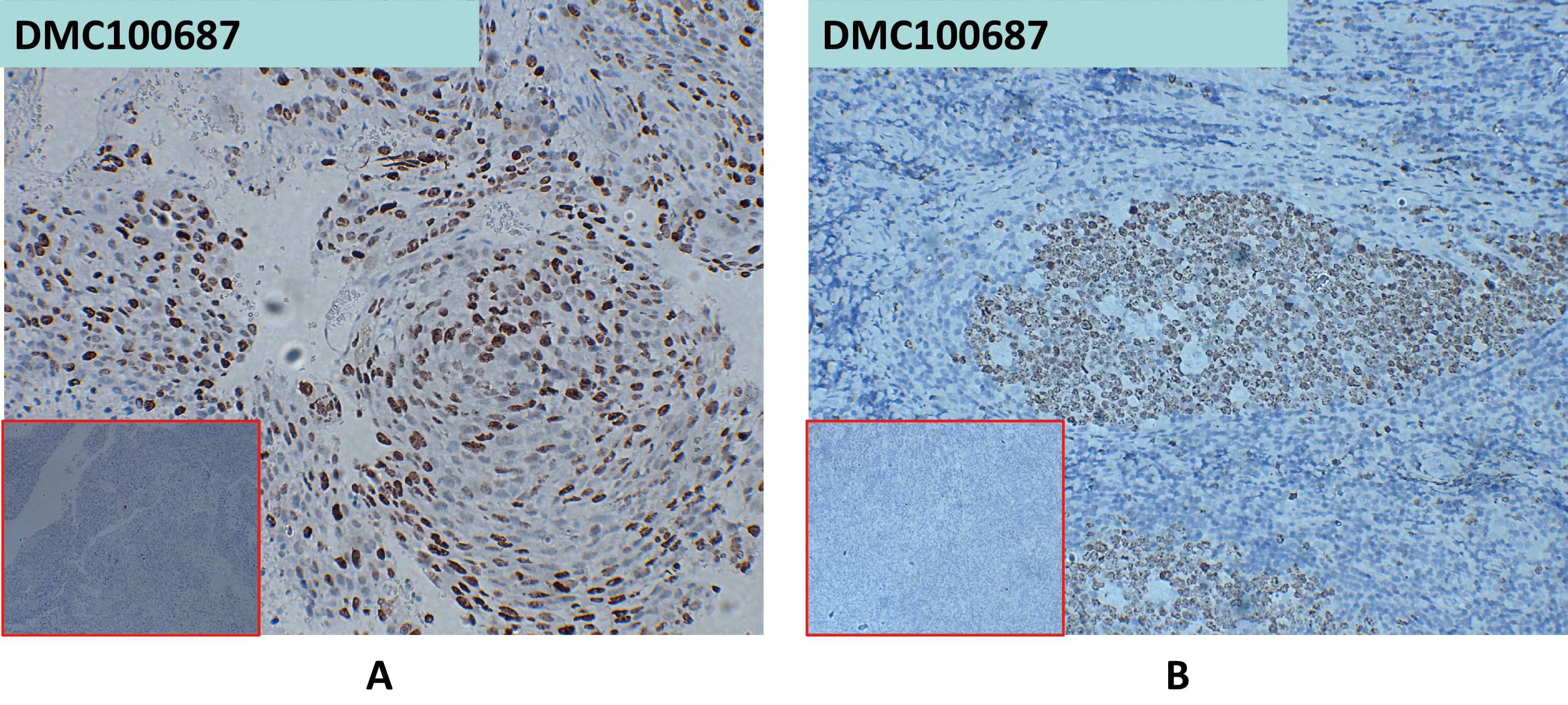 A. NBP3-48384 at 10ug/ml staining CXADR in Huh7 xenografts in nude mice by IHC (Catalog Number# NBP3-48384);B. NBP3-48384 at 10ug/ml staining CXADR in human tonsil tissue by IHC (Catalog Number# NBP3-48384)