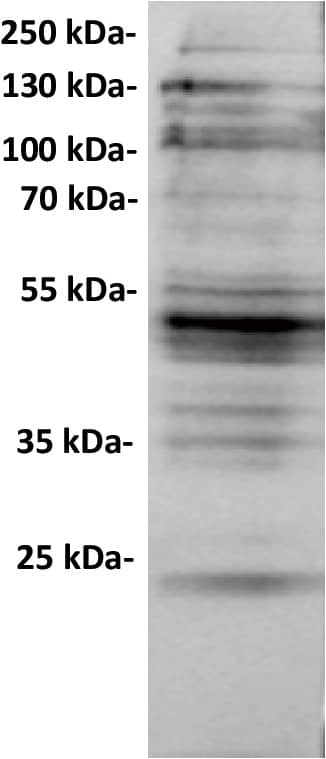 Anti-CXADR antibody (Catalog Number# NBP3-48384) at 1/1000 dilutionLane : Huh7, whole cell lysateSecondary : Goat Anti-Rabbit IgG H&L (HRP) at 1/5000 dilutionPredicted band size: 40 kDaObserved band size: 50 kDa