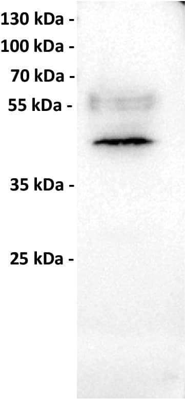 Anti-MICA antibody (Catalog Number# NBP3-48405) at 1/1000 dilutionLane : HeLa (human cervical adenocarcinoma epithelial cell), whole cell lysateSecondary : Goat Anti-Rabbit IgG H&L (HRP) at 1/5000 dilutionband size: 43 kDa