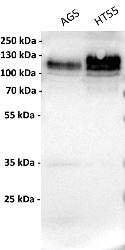 Anti-CDH17 antibody (Catalog Number# NBP3-48406) at 1/1000 dilutionLane 1: AGS, whole cell lysateLane 2: HT55, whole cell lysateSecondary : Goat Anti-Rabbit IgG H&L (HRP) at 1/5000 dilutionPredicted band size: 92 kDaObserved band size: 120 kDa