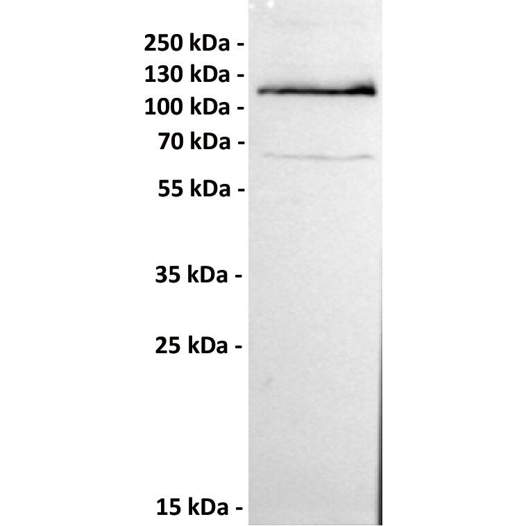 Anti-ROR1 antibody (Catalog Number# NBP3-48407) at 1/1000 dilutionLane : 293T-ROR1, whole cell lysateSecondary : Goat Anti-Rabbit IgG H&L (HRP) at 1/5000 dilutionPredicted band size: 104 kDaObserved band size: 110 kDa