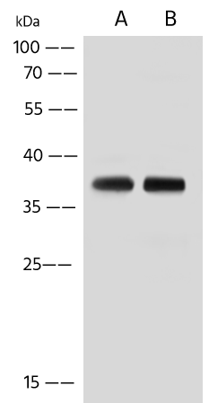 Western Blot: TMUB2 Antibody - Azide and BSA Free [NBP3-48417] - Lane A: HeLa Whole Cell Lysate. Lane B: HepG2 Whole Cell Lysate. Lysates/proteins at 30 ug per lane using NBP3-48417 at 1:500 dilution. Secondary: HRP-conjugated Goat Anti-Rabbit IgG (H+L) at 1/10000 dilution. Developed using the ECL technique. Performed under reducing conditions. Predicted band size: 34 kDa. Observed band size: 37 kDa