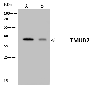 Immunoprecipitation: TMUB2 Antibody - Azide and BSA Free [NBP3-48418] - Lane A: 0.5 mg HeLa Whole Cell Lysate. Lane B: 0.5 mg HepG2 Whole Cell Lysate. Blotted with 4 uL anti-TMUB2 rabbit polyclonal antibody and 60 ug of Immunomagnetic beads Protein A/G. Immunoprecipitated using NBP3-48418 at 1:100 dilution and HRP-conjugated secondary antibody at 1:1000 dilution. Developed using the ECL technique. Performed under reducing conditions. Predicted band size: 34 kDa. Observed band size :38 kDa