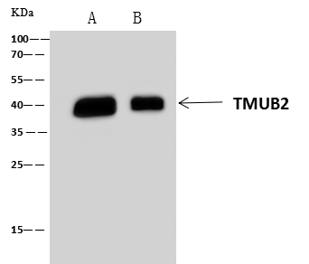 Immunoprecipitation: TMUB2 Antibody - Azide and BSA Free [NBP3-48419] - Lane A: 0.5 mg HeLa Whole Cell Lysate. Lane B: 0.5 mg HepG2 Whole Cell Lysate. Blotted with 4 uL anti-TMUB2 rabbit polyclonal antibody and 60 ug of Immunomagnetic beads Protein A/G. Immunoprecipitated using NBP3-48419 at 1:100 dilution and HRP-conjugated secondary antibody at 1:1000 dilution. Developed using the ECL technique. Performed under reducing conditions. Predicted band size: 34 kDa. Observed band size :38 kDa