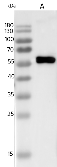 Western Blot: Human Mastadenovirus B Encapsidation Protein IVa2 Antibody [NBP3-48431] - Lane A: Human Mastadenovirus B Encapsidation Protein IVa2 (5ng) using NBP3-48431 at 1:5000 dilution. Secondary: HRP-conjugated Goat Anti-Rabbit IgG (H+L) at 1/10000 dilution. Developed using the ECL technique. Performed under reducing conditions.