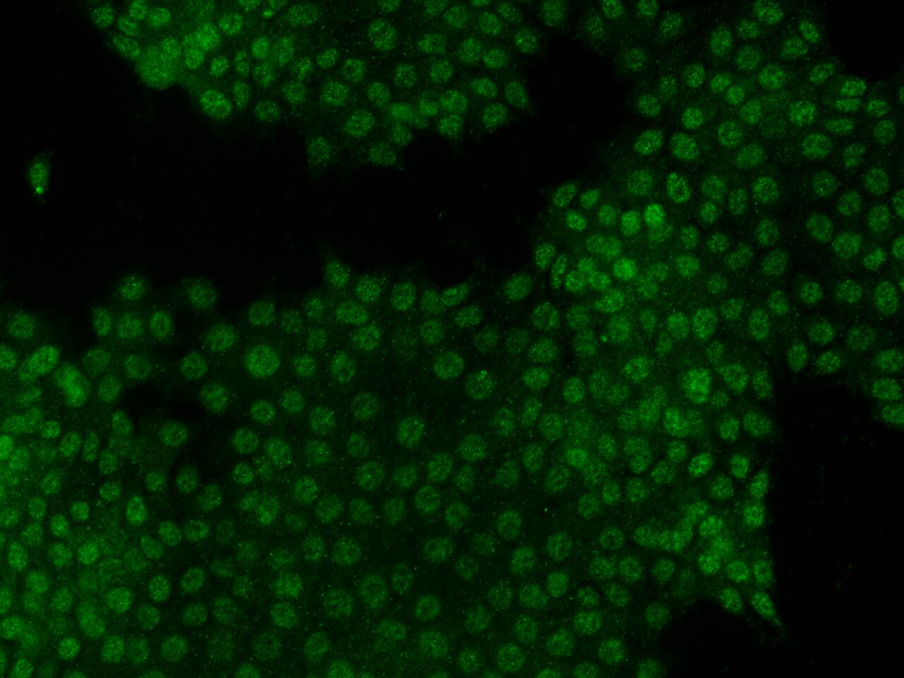 Immunocytochemistry/ Immunofluorescence: IRX4 Antibody - Azide and BSA Free [NBP3-48420] - Immunofluorescence staining of IRX4 in MCF7 cells. Cells were fixed with 4% PFA, permeabilzed with 0.3% Triton X-100 in PBS,blocked with 10% serum, and incubated with NBP3-48420 (dilution ratio 1:100) at 4C overnight. Then cells were stained with Alexa Fluor®488-conjugated Goat Anti-rabbit IgG secondary antibody (green). Positive staining was localized to Nucleus.