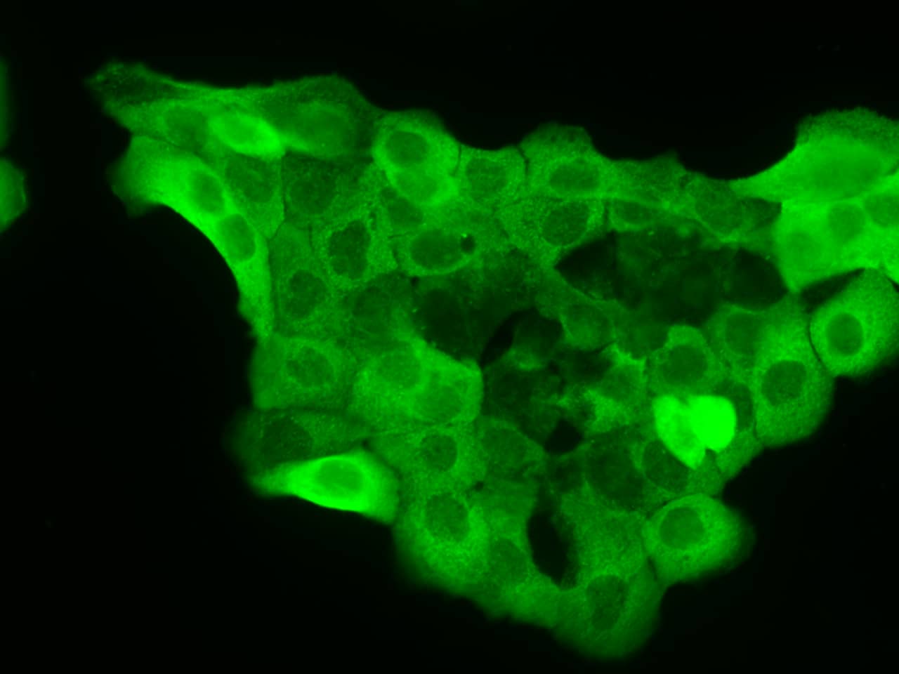 Immunocytochemistry/ Immunofluorescence: TMUB2 Antibody - Azide and BSA Free [NBP3-48419] - Immunofluorescence staining of TMUB2 in A431 cells. Cells were fixed with 4% PFA, permeabilzed with 0.3% Triton X-100 in PBS, blocked with 10% serum, and incubated with NBP3-48419 (dilution ratio 1:100) at 4C overnight. Then cells were stained with Alexa Fluor®488-conjugated Goat Anti-rabbit IgG secondary antibody (green). Positive staining was localized to Cytoplasm.