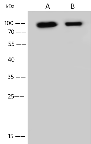 Western Blot: GGA3 Antibody - Azide and BSA Free [NBP3-49156] - Lane A: SH-SY5Y Whole Cell Lysate. Lane B: A431 Whole Cell Lysate. Lysates/proteins at 30 ug per lane using NBP3-49156 at 1:500 dilution. Secondary: HRP-conjugated Goat Anti-Rabbit IgG (H+L) at 1/10000 dilution. Developed using the ECL technique. Performed under reducing conditions. Predicted band size: 78 kDa. Observed band size: 95 kDa