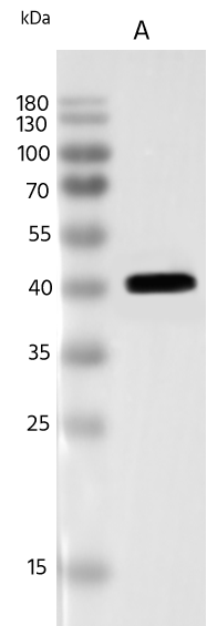 Western Blot: Human Mastadenovirus E Fiber Antibody [NBP3-48430] - Lane A: Human Mastadenovirus E Fiber Protein (5ng) using NBP3-48430 at 1:5000 dilution. Secondary: HRP-conjugated Goat Anti-Rabbit IgG (H+L) at 1/10000 dilution. Developed using the ECL technique. Performed under reducing conditions.