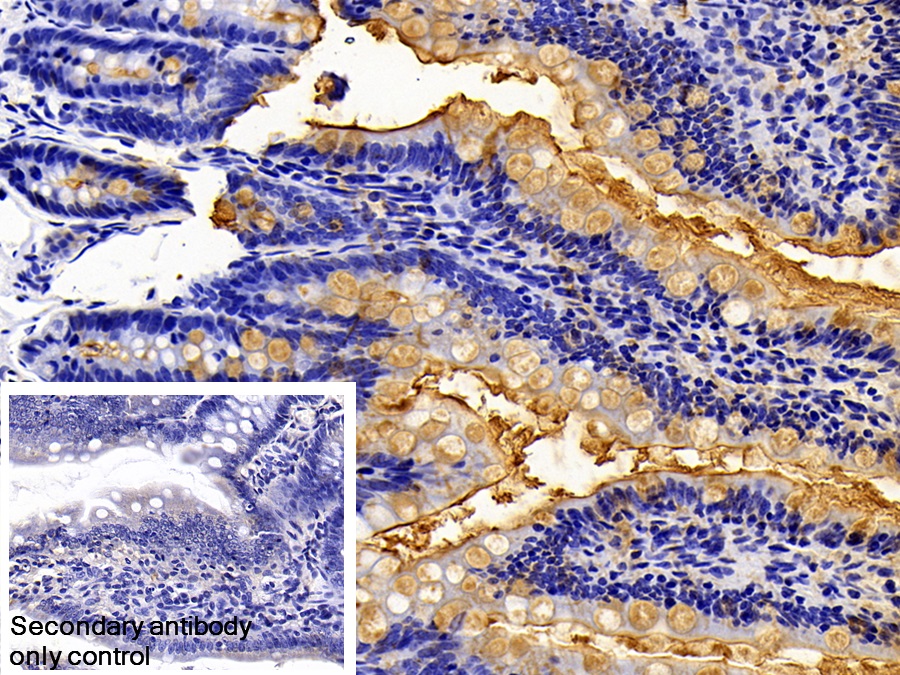 Immunohistochemistry-Paraffin: Lipopolysaccharide Antibody - BSA Free [NBP3-43706] - DAB staining of Rat Colon Tissue. Primary Ab: 10µg/ml NBP3-43706.  Second Ab: 2µg/ml HRP-conjugated Goat Anti-Rabbit IgG Polyclonal Antibody. Control: Used PBS instead of primary antibody