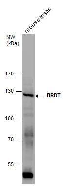 BRDT antibody detects BRDT protein by western blot analysis. Mouse tissue extracts (50 ug) was separated by 7.5 % SDS-PAGE, and the membrane was blotted with BRDT antibody (NBP3-48438) at a dilution of 1:500. 