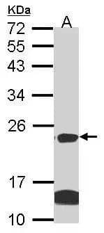 Sample (30 ug of whole cell lysate)  A: Hela  B: Hep G2  12% SDS PAGE  NBP3-48441 diluted at 1:1000  