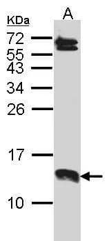 Sample (30 ug of whole cell lysate)  A: A431 was used to detect the primary antibody. 