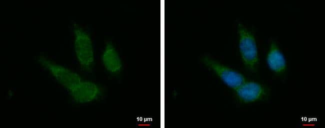 PTOV1 antibody detects PTOV1 protein at cytoplasm by immunofluorescent analysis.Sample: HCT116 cells were fixed in 4% paraformaldehyde at RT for 15 min.Green: PTOV1 protein stained by PTOV1 antibody (NBP3-48444) diluted at 1:500.Blue: Hoechst 33342 staining. 
