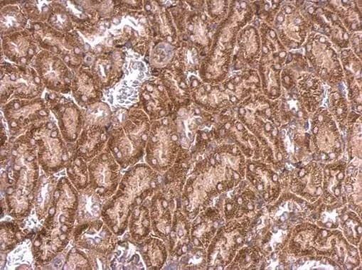 Immunohistochemistry PPEF2 Antibody